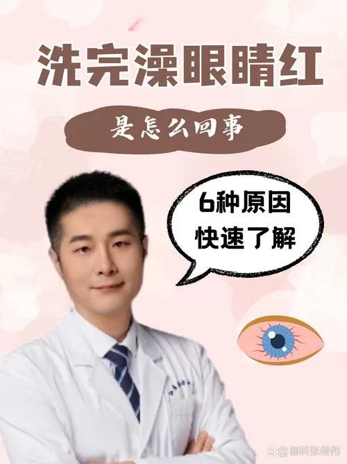 洗头发为什么眼睛红