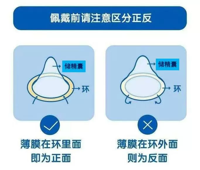避孕套正反怎么区分
