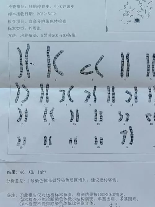 十三染色体异常是什么造成的截图