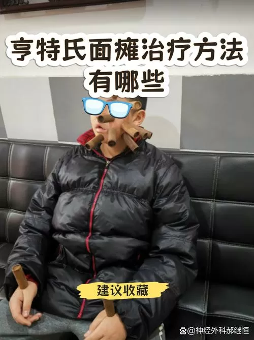 风吹导致面瘫怎么治疗